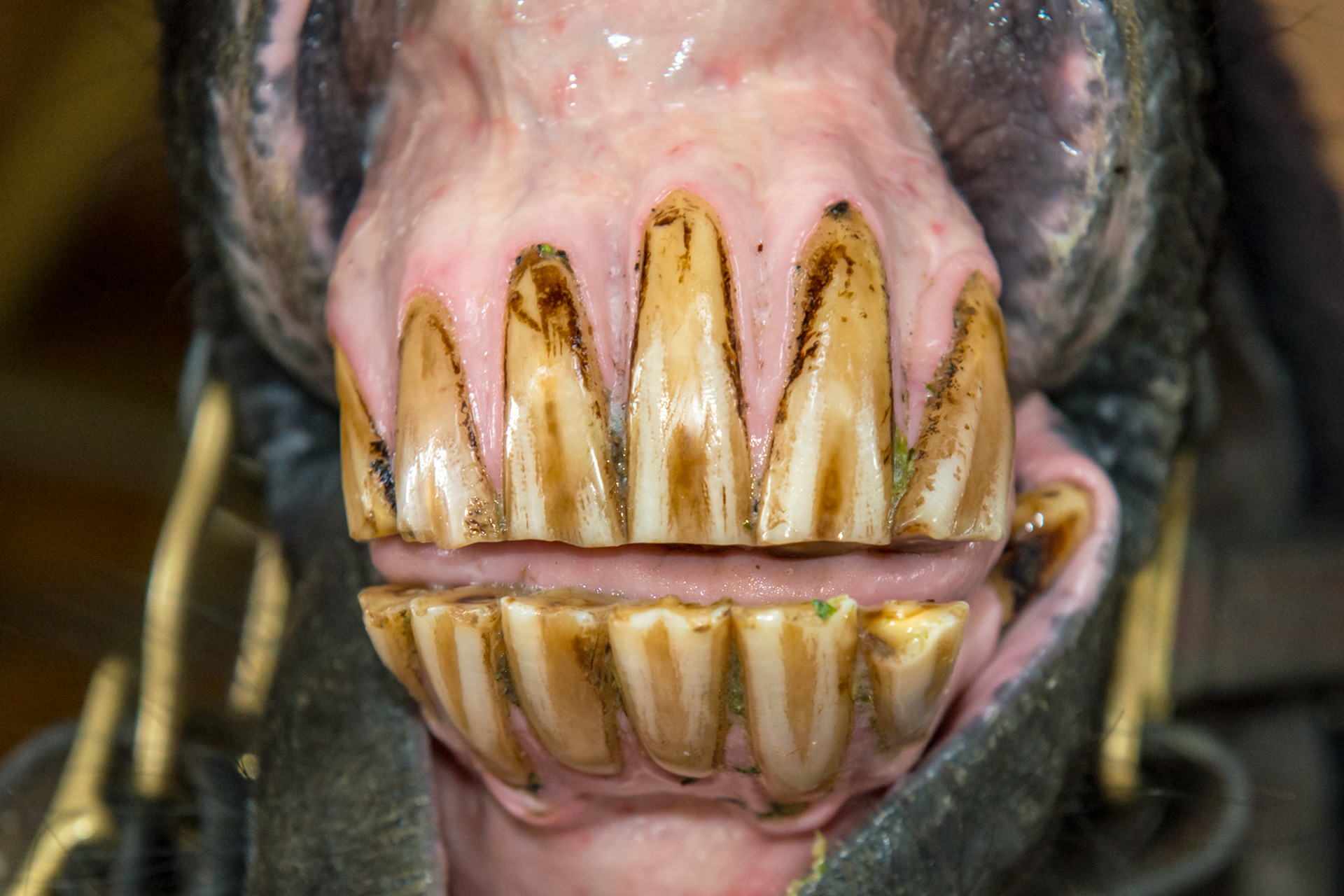 27yr 3mo - EOTRH and an underbite but only from the forward displacement of the lower left incisors. Note more receding gums on the lower left tongue side and upper left lip side than on the right.