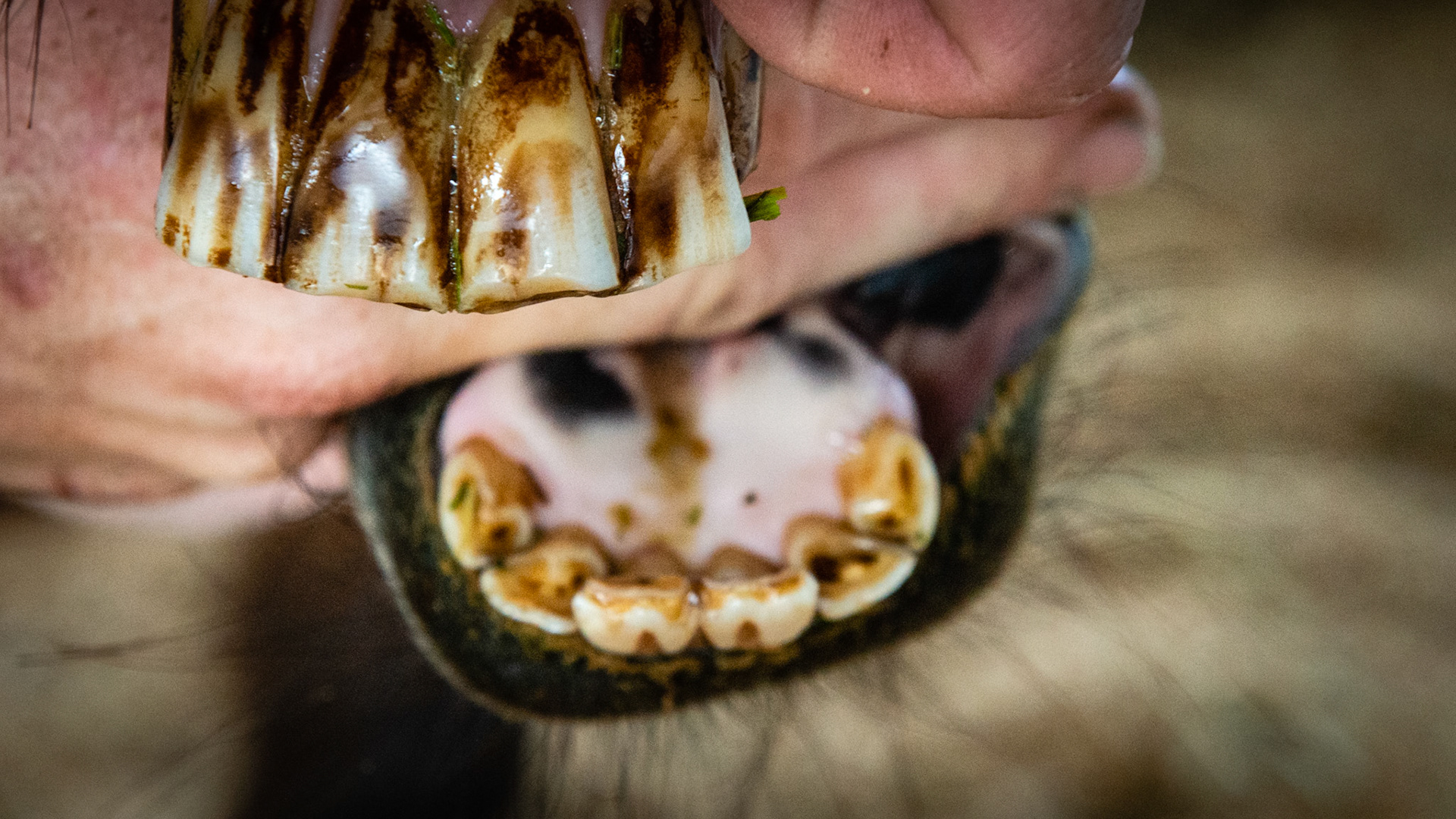 301 and 302 are over erupted and wear on the labial surface of the opposing upper incisors.