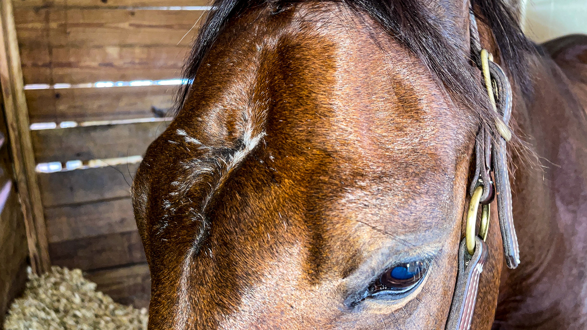 Old skull trauma over the sinus area. Towards the ears is thicker bone covering the brain.