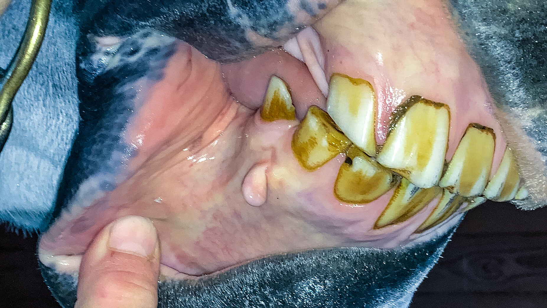 A soft non-painful growth on the gums. Most likely there since birth.
