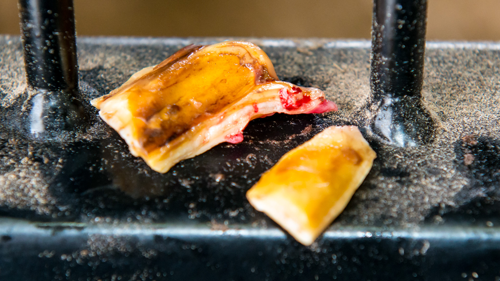 Cheek teeth fracture horse 8 -Extraction of fractured piece from buccal 107 with associated buccal ulcer. The medial edge of the fractured piece with the attached gum. The fractured piece was itself fractured into 2 pieces. Note the extended piece of tooth beyond the fractured edge.
