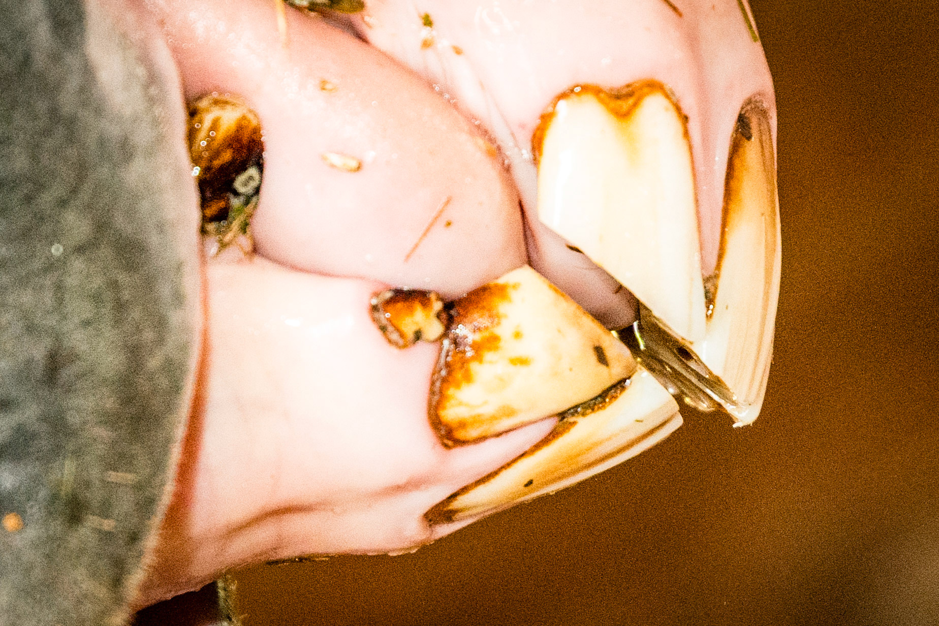 13yr 3mo - incisor cap remnants next to 203 and 403