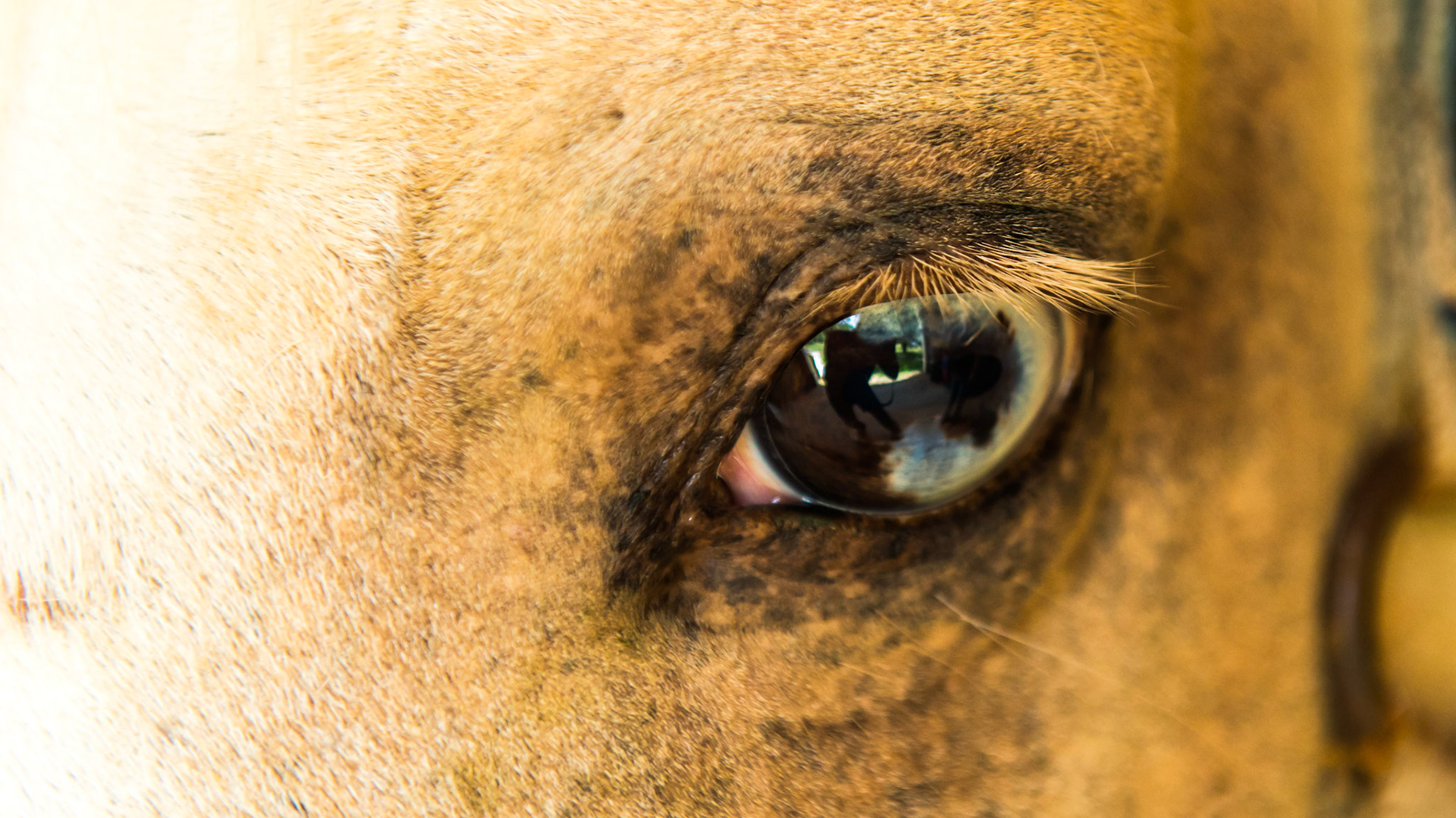 Half blue iris and half brown iris is not common but is normal in this eye.