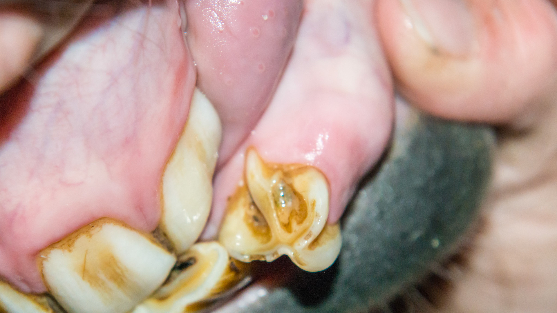 Horse M - 303 malformed. It looks more like a cheek tooth. The soft tissue between 302 and 303 is inflammed and raw but has no odor and is not painful.  The tongue cannot reach this area to clean it but the tooth has been smoothed indicating she has tried. Plan - either remove it (surgery with not improvement in mare's condition) or leave it (it's not bothering her, it may self resolve as she erupts more over time, or it will be easier to extract when the soft tissue deteriorates more