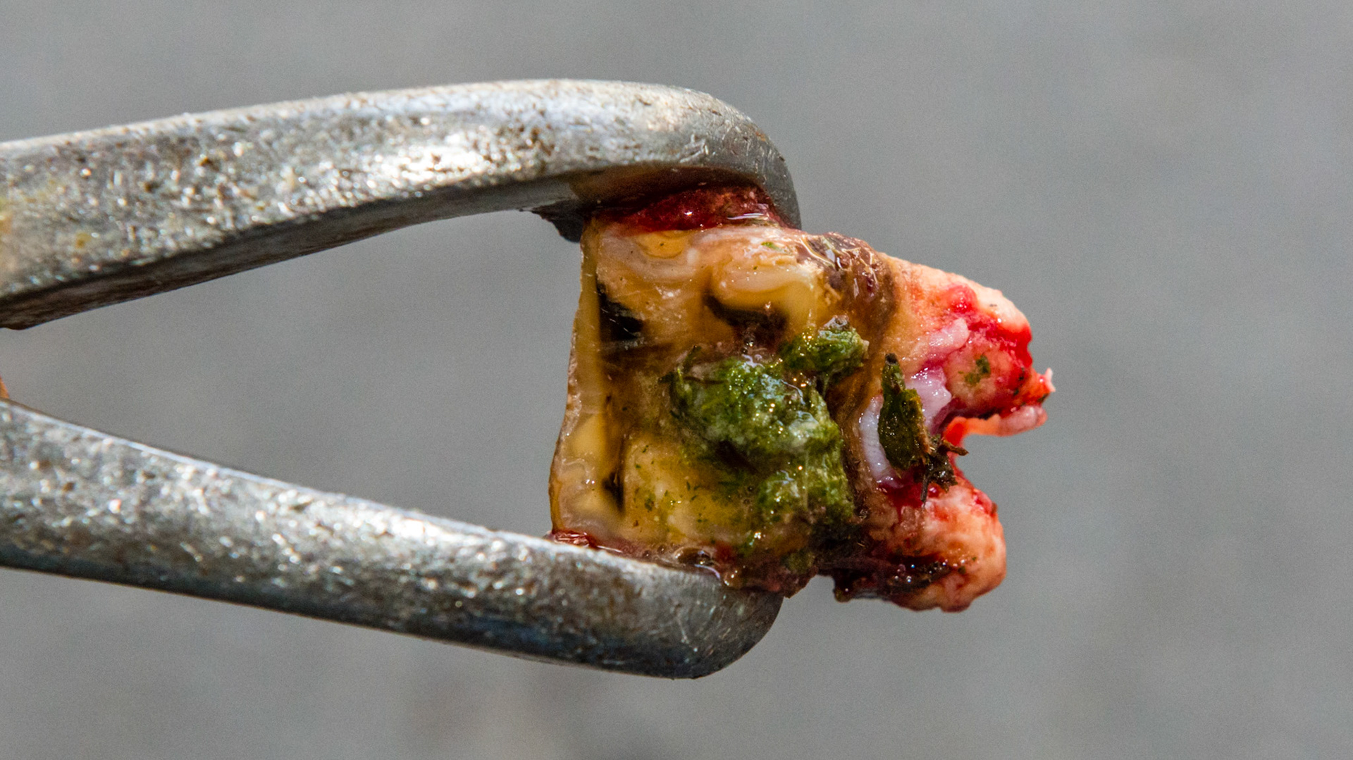 #211 in a 24 year old pony. Malodor and loose when filed. Non-painful and was extracted with these upper cap pullers without any pain medication. Extracted because of odor and he had already lost 111 and 110 and he lives a day away. Note the feed packed under the tooth.