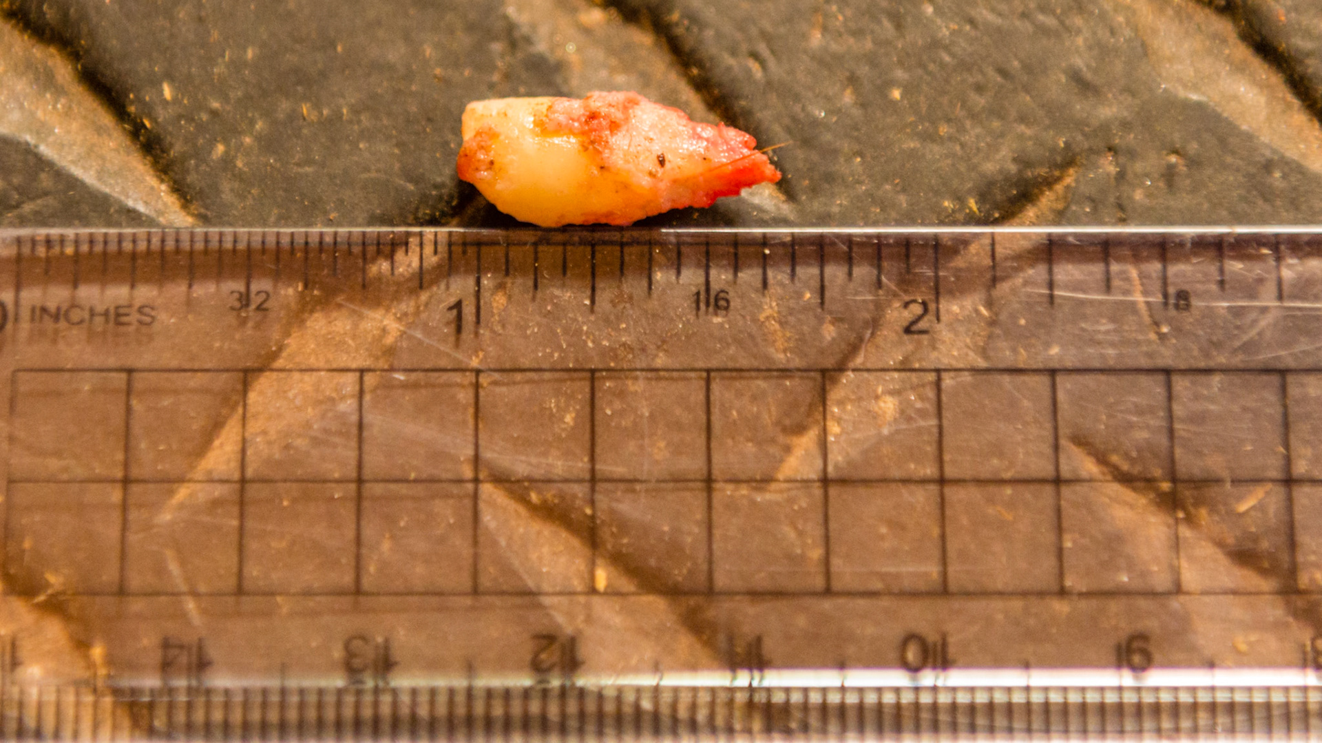 A blind wolf tooth in a 7yr old WB G that had just erupted so that its sharp tip was exposed.  This tooth took ablut 25 min to extract.  The crown is shorter because it was reduced in the process of extraction by about ¼ inch (6mm).