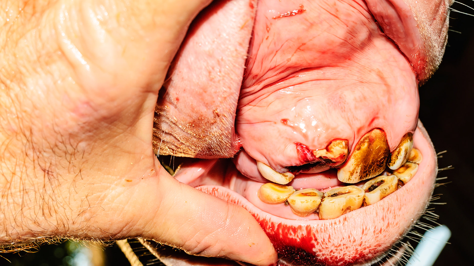 Incisor cap extractions horse 1 -Retained cap #502 (middle upper right incisor) is extracted to allow the correct placement of the permanent tooth remaining above it.