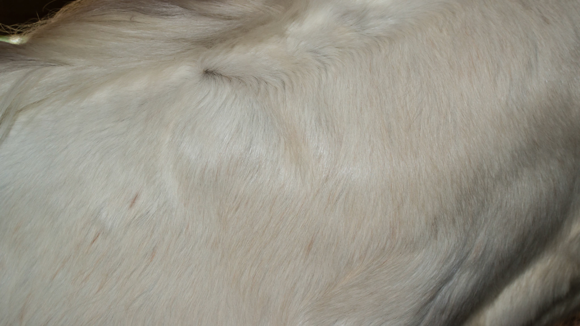 Melanoma in a 25 yr old on the neck.