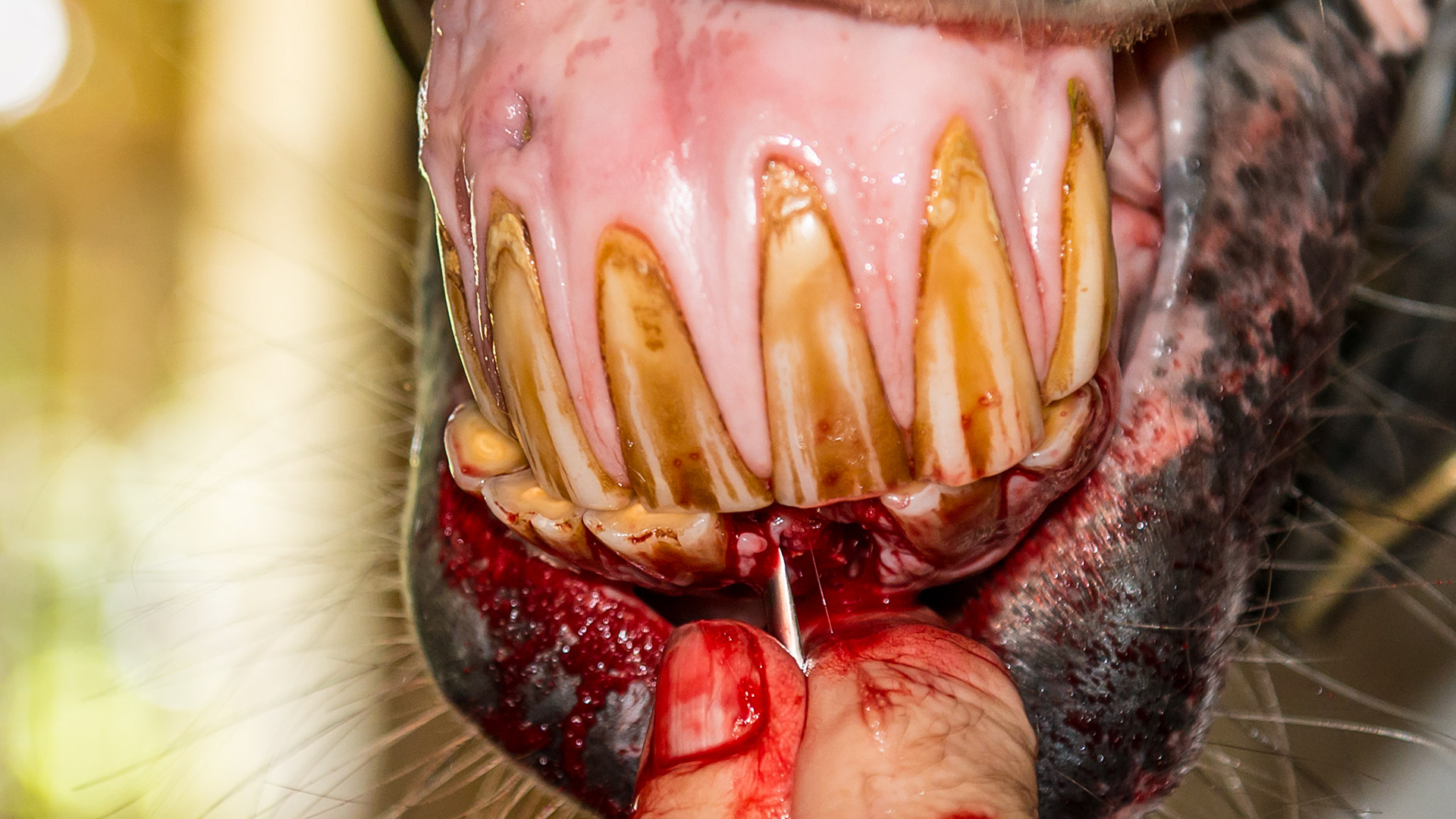 EOTRH horse 17 - #301 coronal fracture due to EOTRH with tooth fragments remaining. Removal of the avulsed alveolus using a wolf tooth elevator and thumb. NOTE - signs of EOTRH with resorption above 102