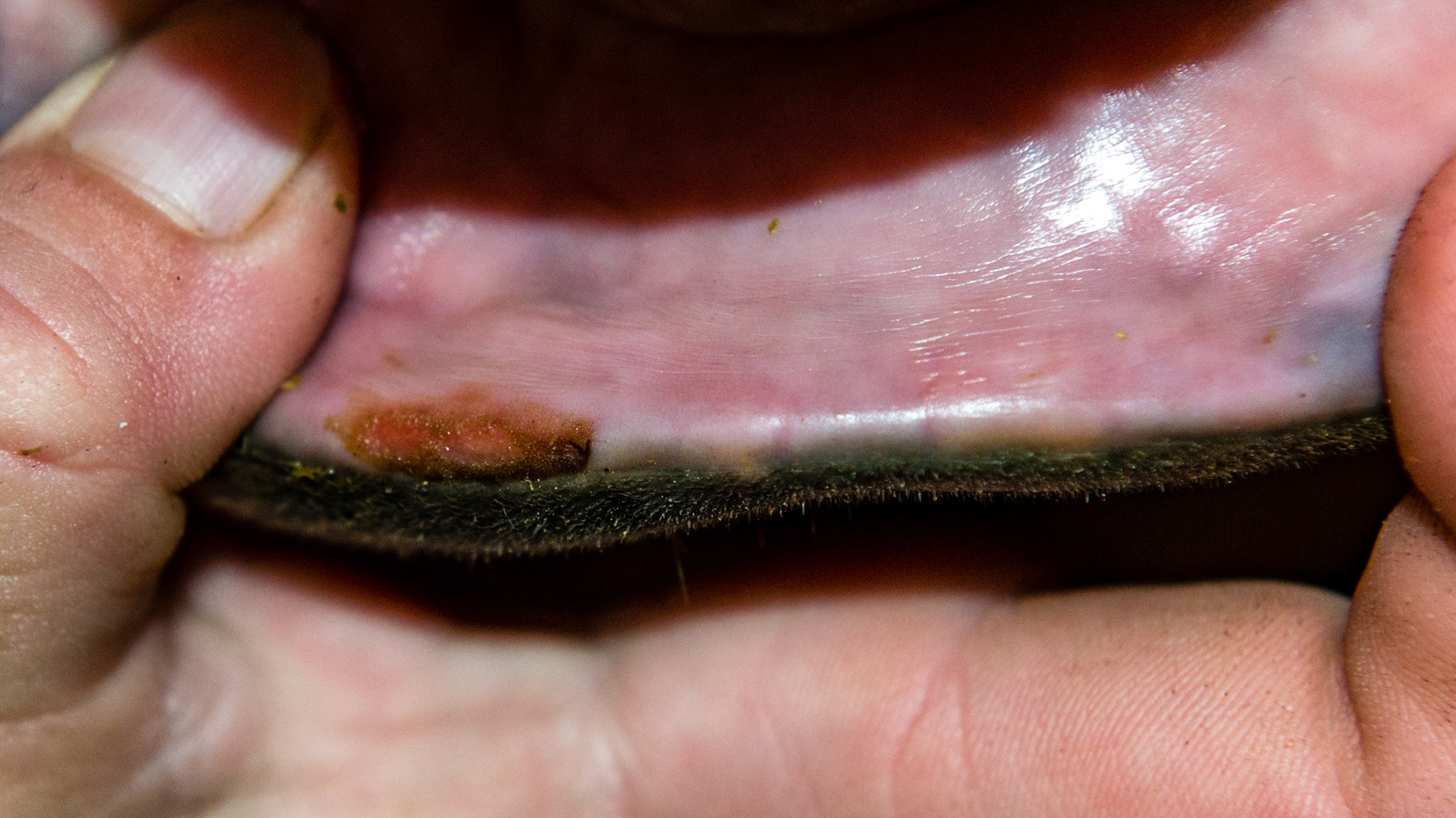 Lip biting on 1 incisor