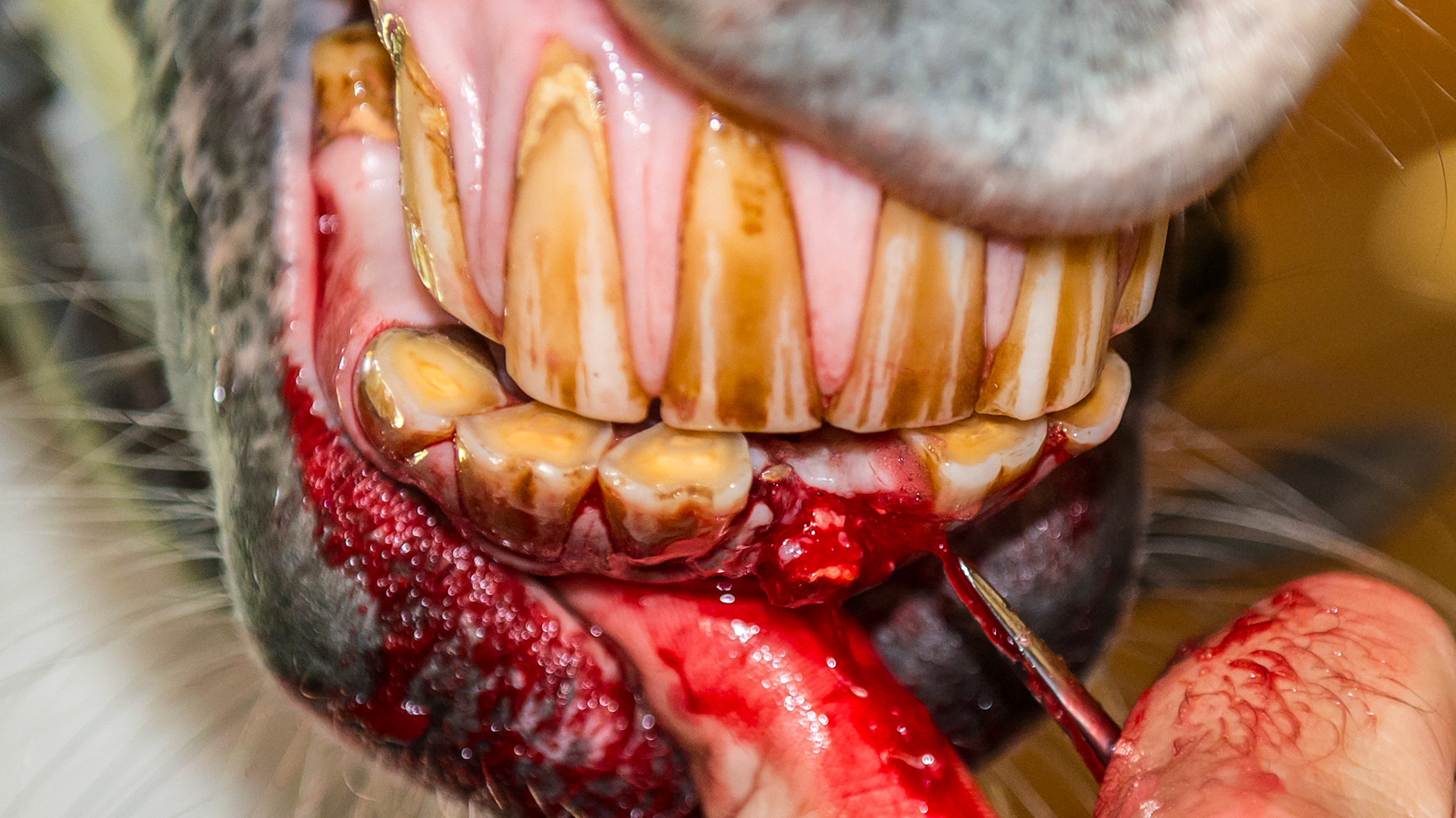 EOTRH horse 17 - #301 coronal fracture due to EOTRH with tooth fragments remaining. Removal of the avulsed alveolus using a wolf tooth elevator and thumb.