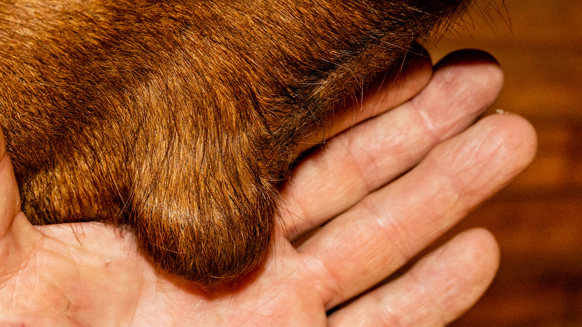 Boney lump that has enlarged from birth in this 25 yr old