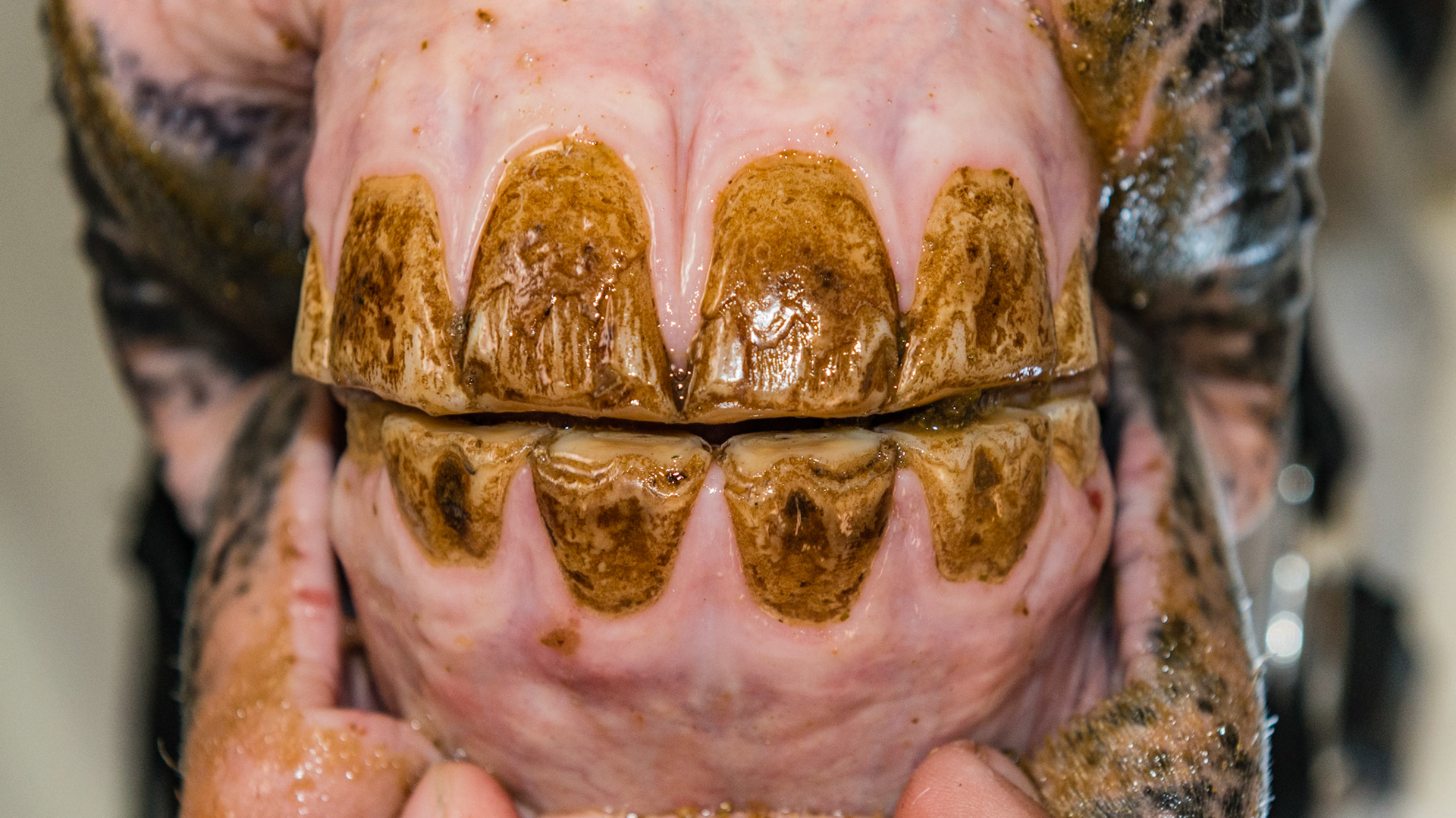 5/9/2008 = 06yr 1mo WB G - Damaged and stained surfaces of all incisors.  Unknown history.