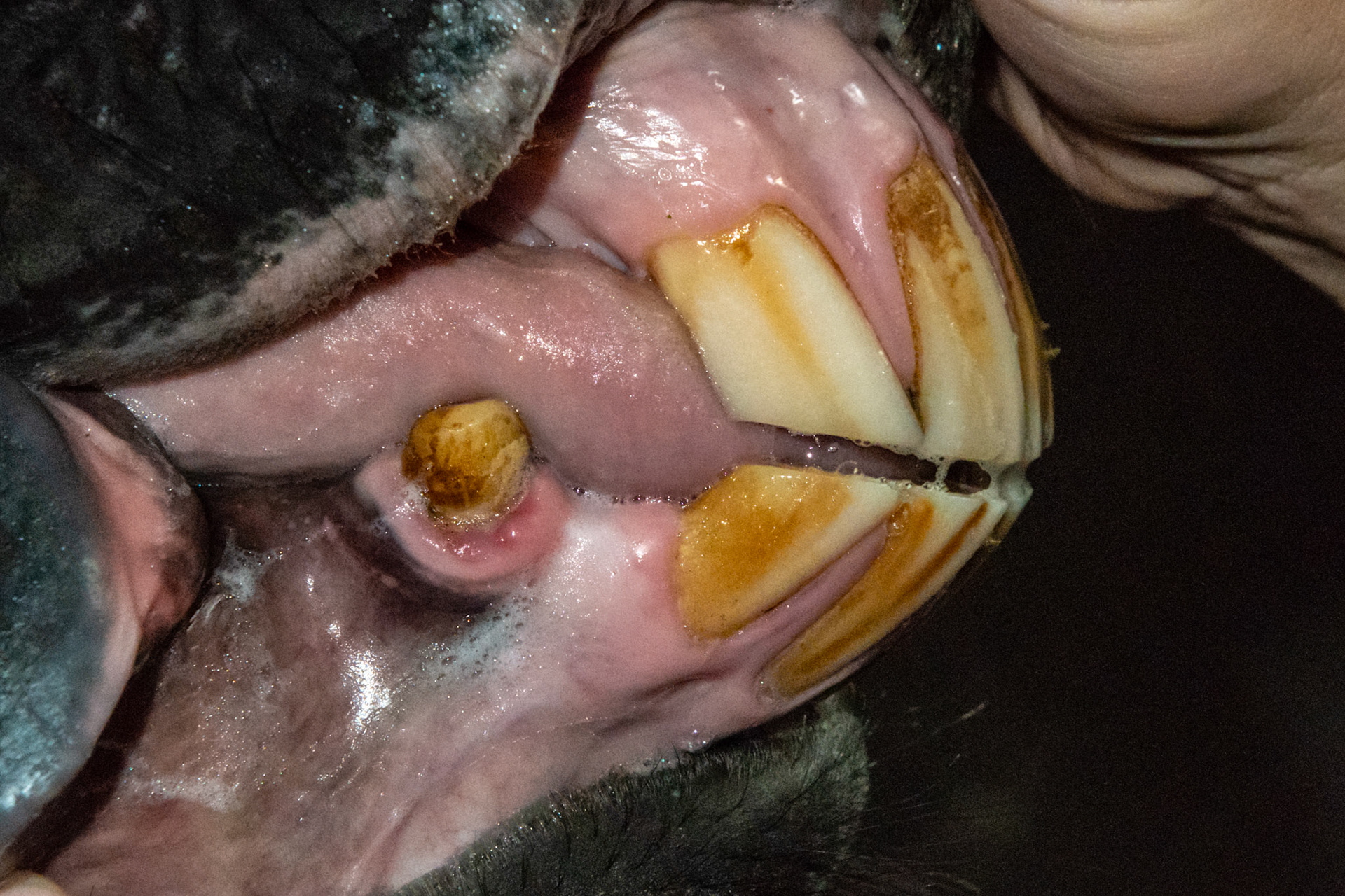 16yr 5mo - Early stage of EOTRH with thickening of the gums around the canines, #404 early necrosis, bulbous appearance of incisors. No pain of difficulty in using incisors.