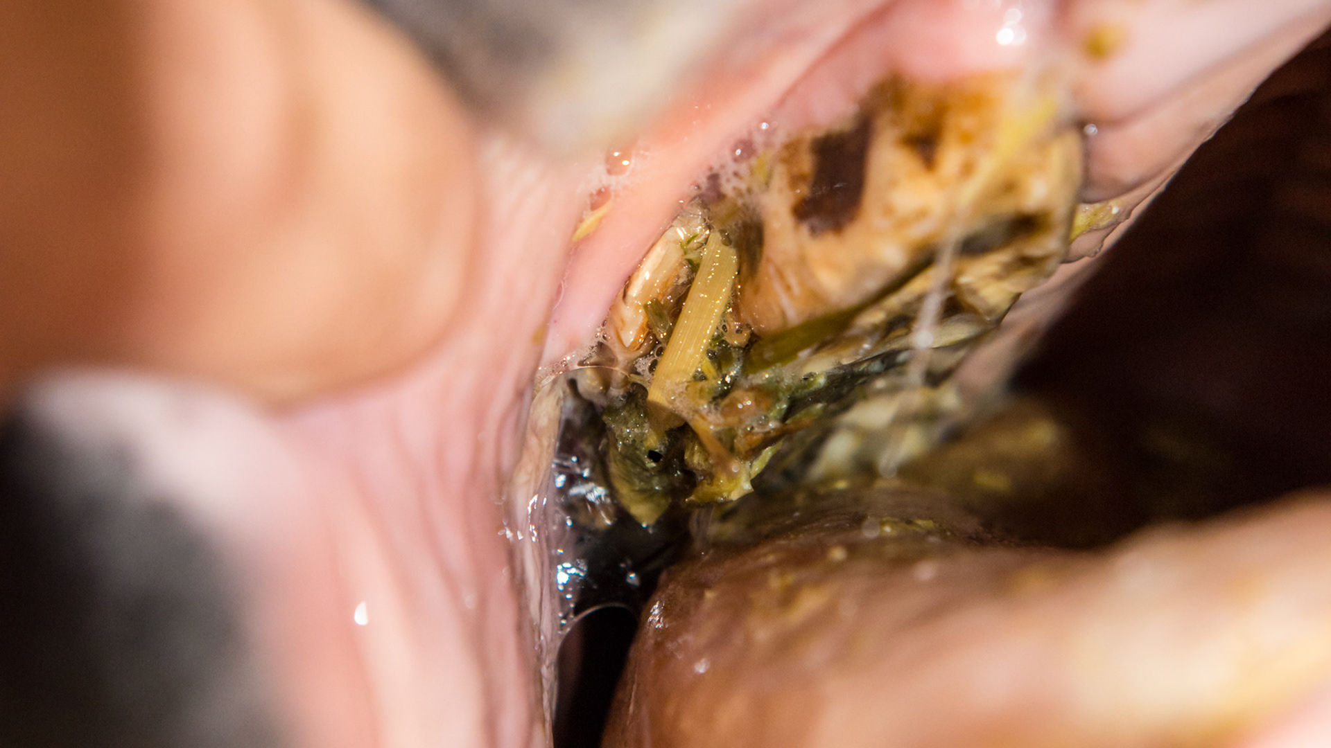Cheek teeth fracture horse 8 -Extraction of fractured piece from buccal 107 with associated buccal ulcer.  Space between fractured piece and 107 is packed with hay.