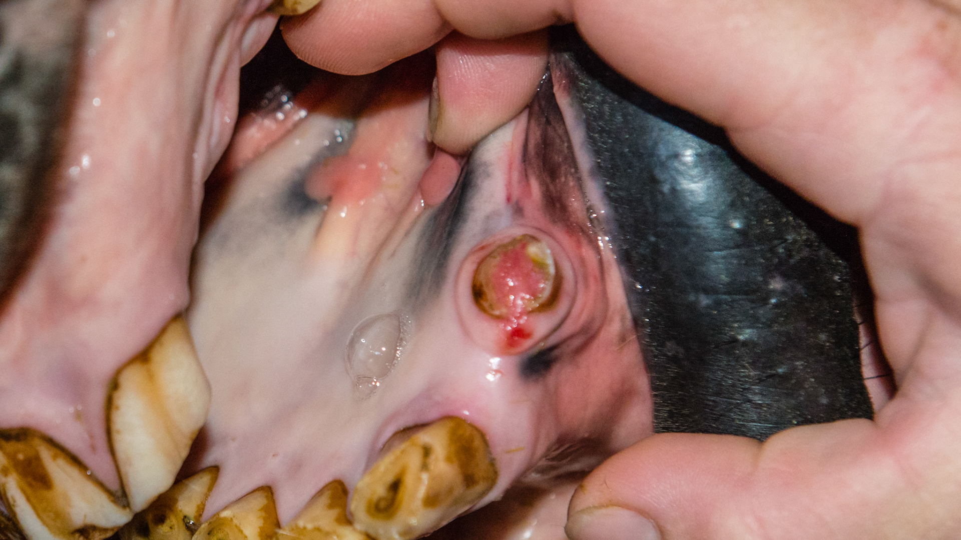 Fractured 304 with granulation tissue. Non-painful.
