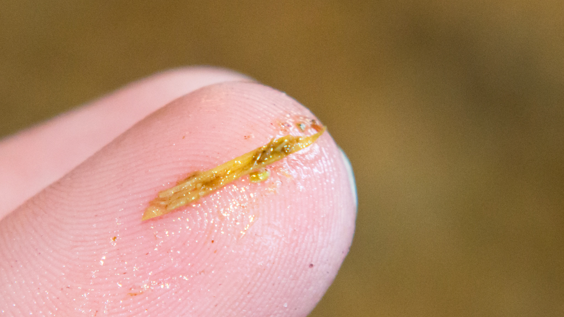 Hole - Small hole in gum above #205 where a foreign object was palpated.  It was non-painful. The first piece of hay.