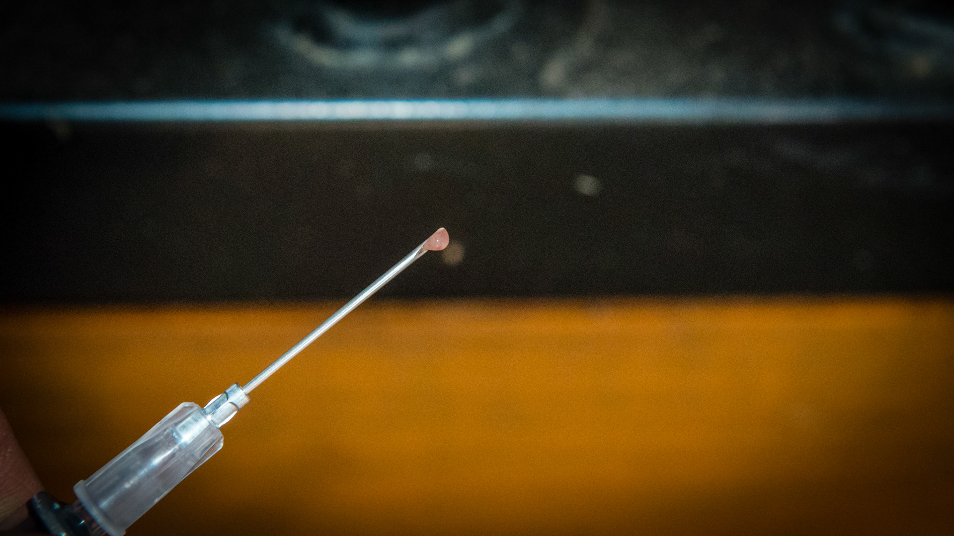 5/6 The pus from the rostral lump on the tip od a 20ga needle.