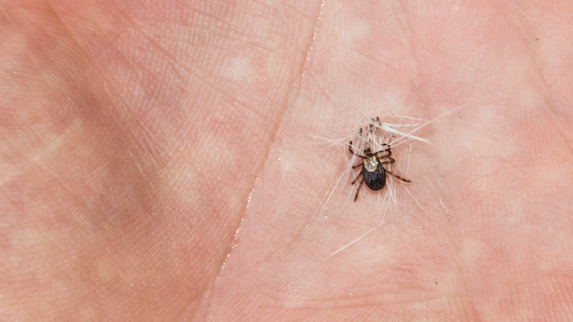 Tick on forehead below left ear, now on my palm.