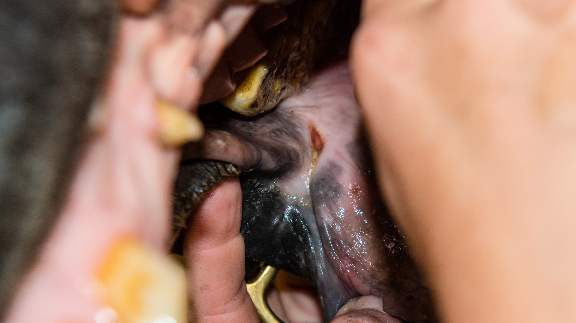 Chronic cut at the corner of the lip.