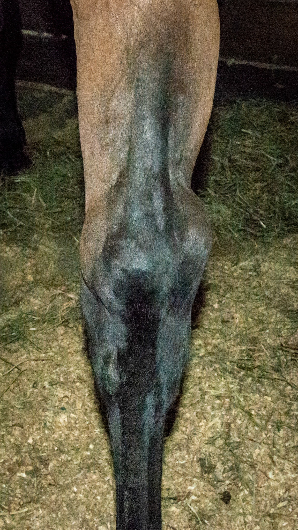 Thoroughpin - The fluid within the joint space bulges to the outside of the hock.  When it is pressed with the fingers, the fluid displaces across the hock to bulge out the other side.  It is either an over-production of joint fluid, an inability to drain or both. In this horse it was a sudden onset (overnight) with no pain. Most thoroughpins are not painful.