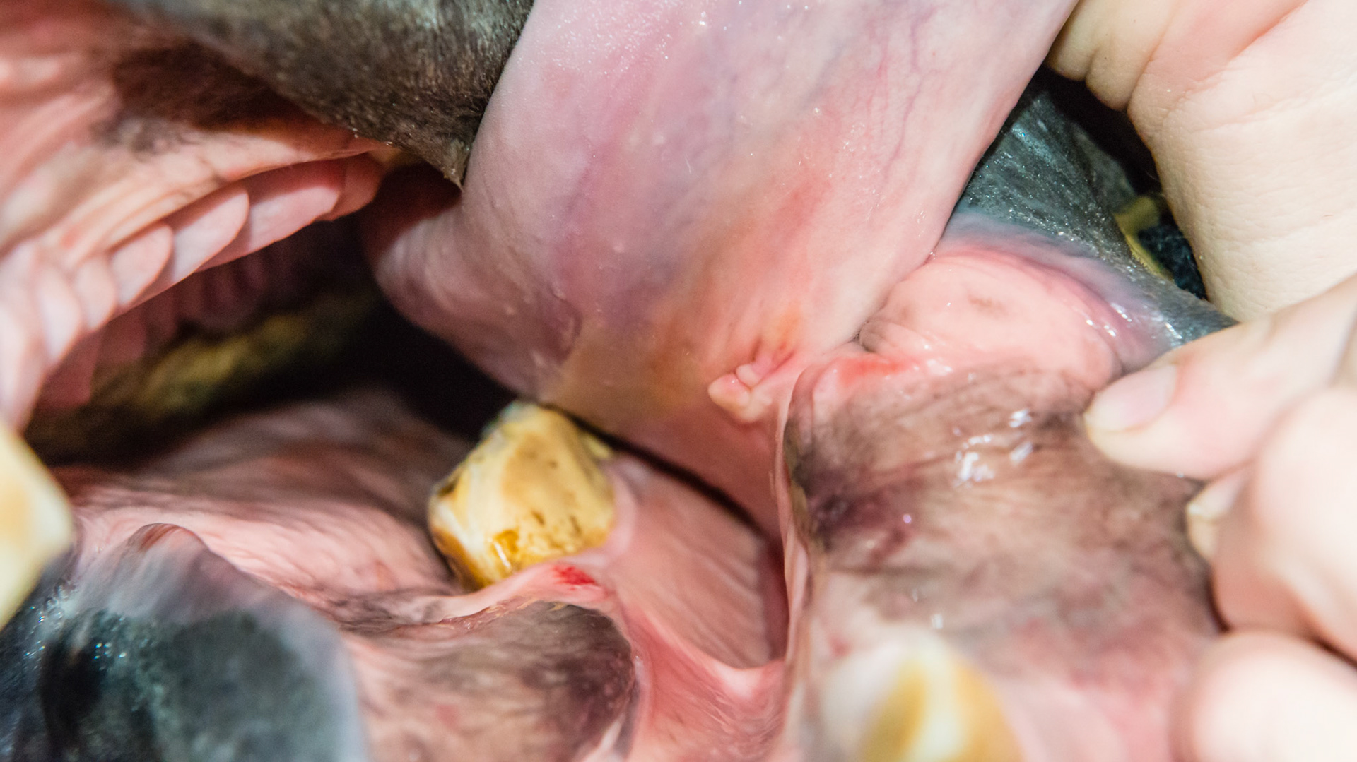 Staple - 6 month follow up to the staple removal from the underside of the tongue.