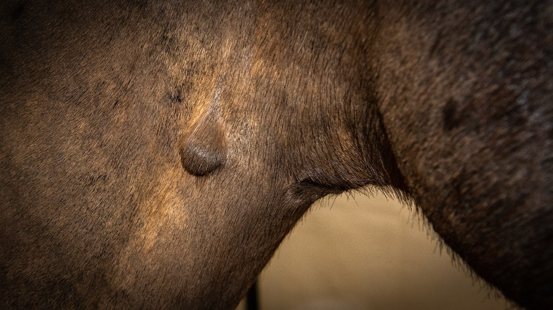 Firm lump over the right jugular vein. It is in the skin and the vein is not affected.