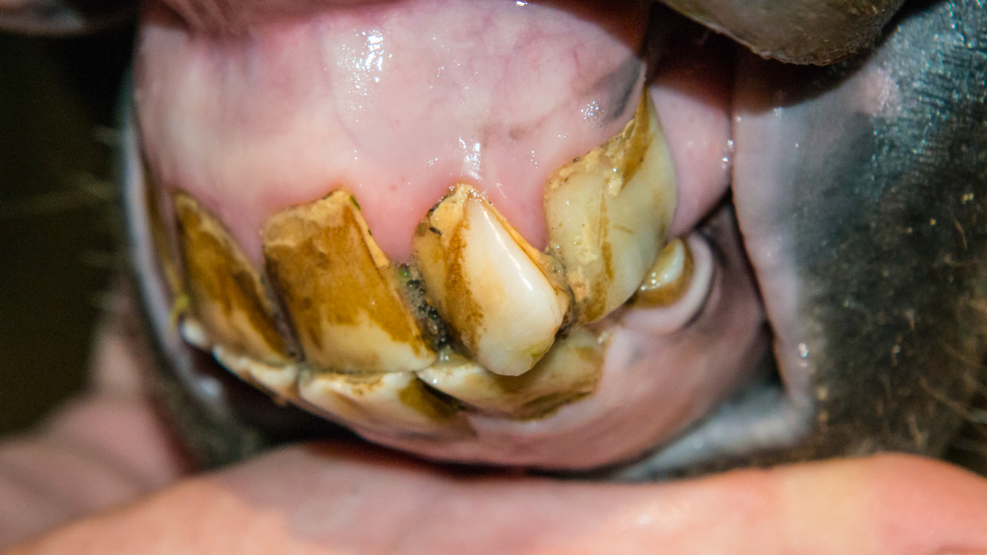 Abnormally positioned upper incisor.