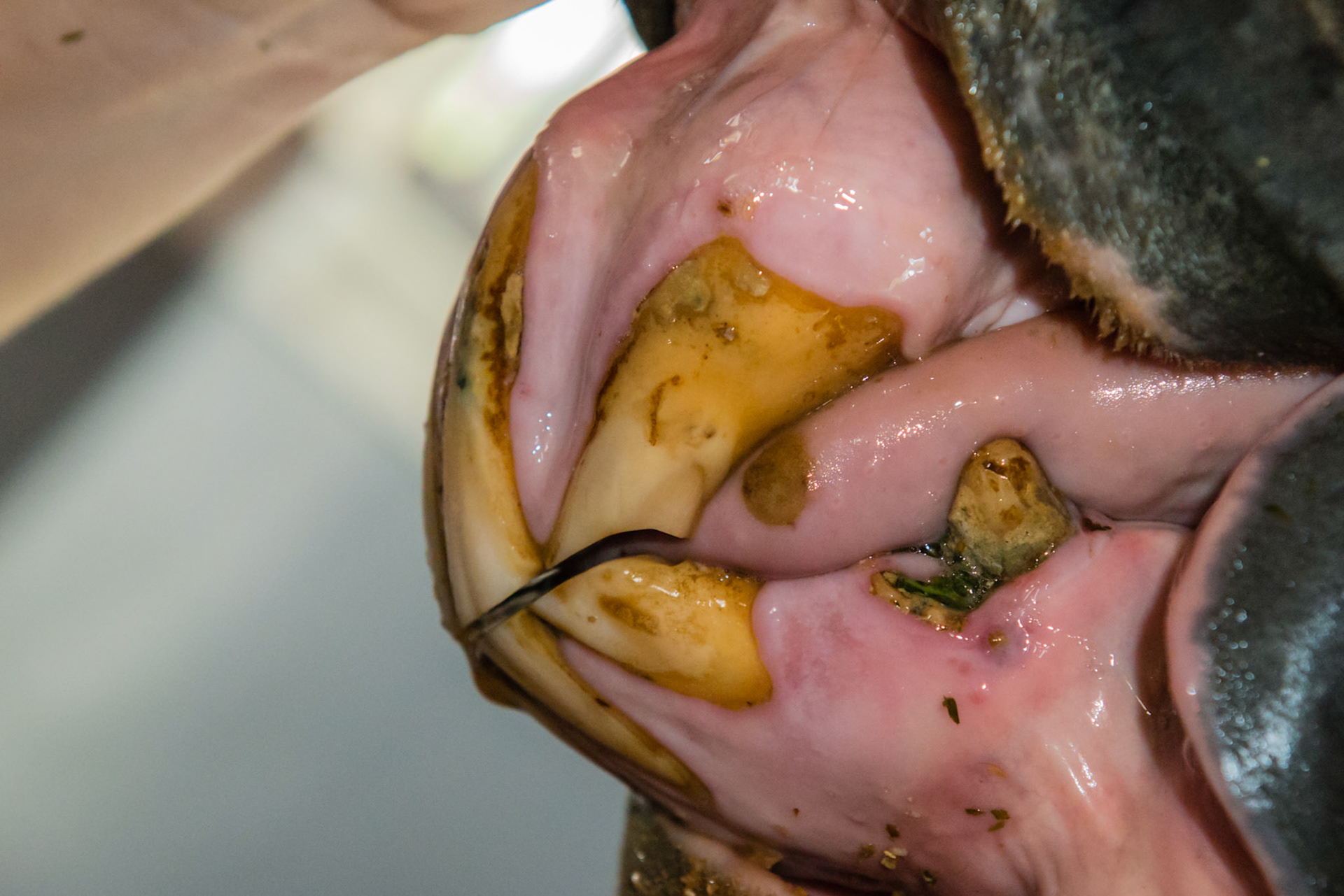 27yr old, EOTRH root enlargement, gum recession, red dots, tooth decay.