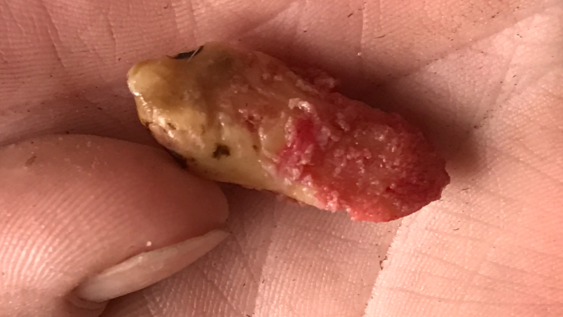 A long wolf tooth with ½ of it embedded in the gum and ½ exposed.