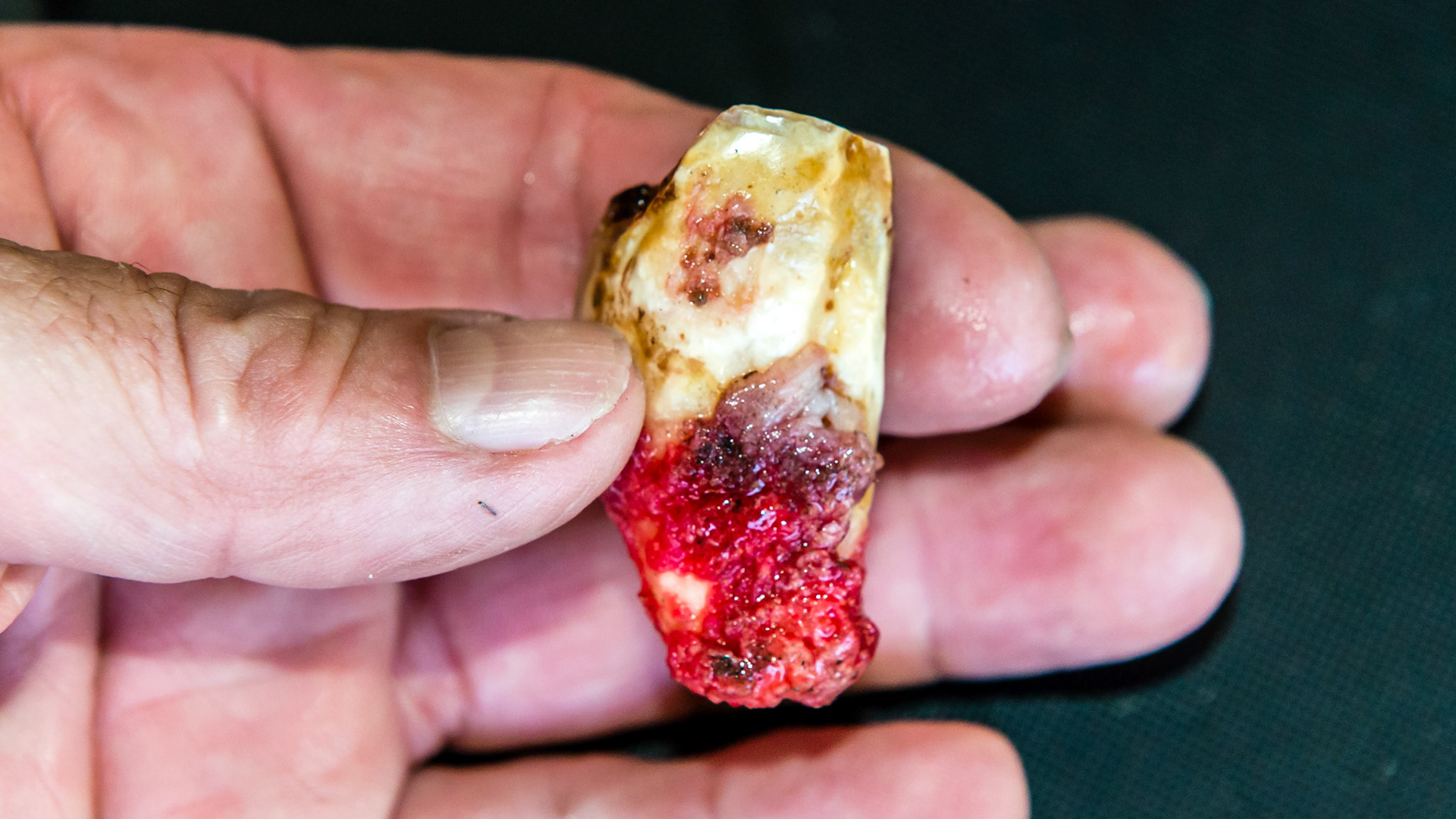 Examples of end stage teeth where the cheek tooth is held in place by only a few tufts of tissue (red). These teeth wiggle under finger pressure and are often extracted by fingers or a slight tug with forceps.