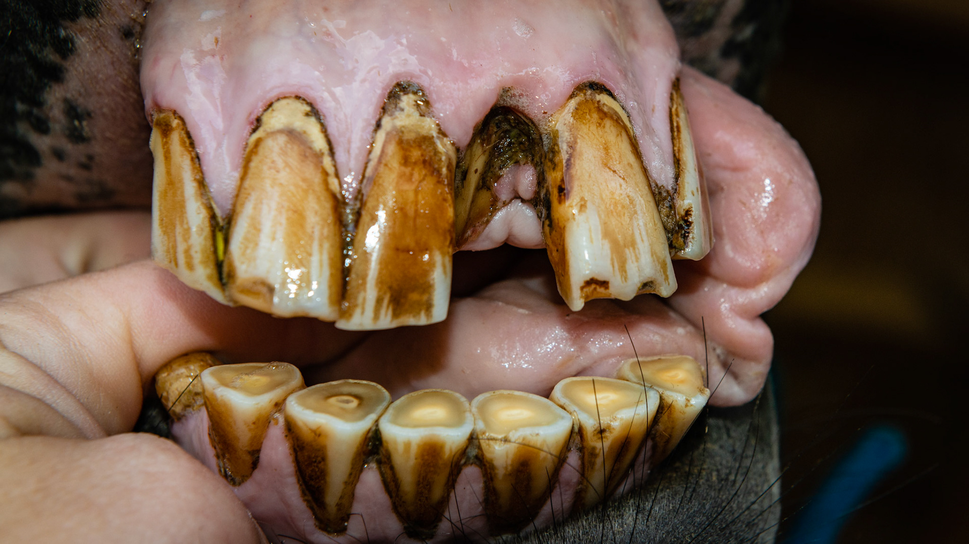 20 year old with a darkened #201 that suddenly fractured. No pain or discomfort, slight smell from decay and trapped food. Owner will watch.