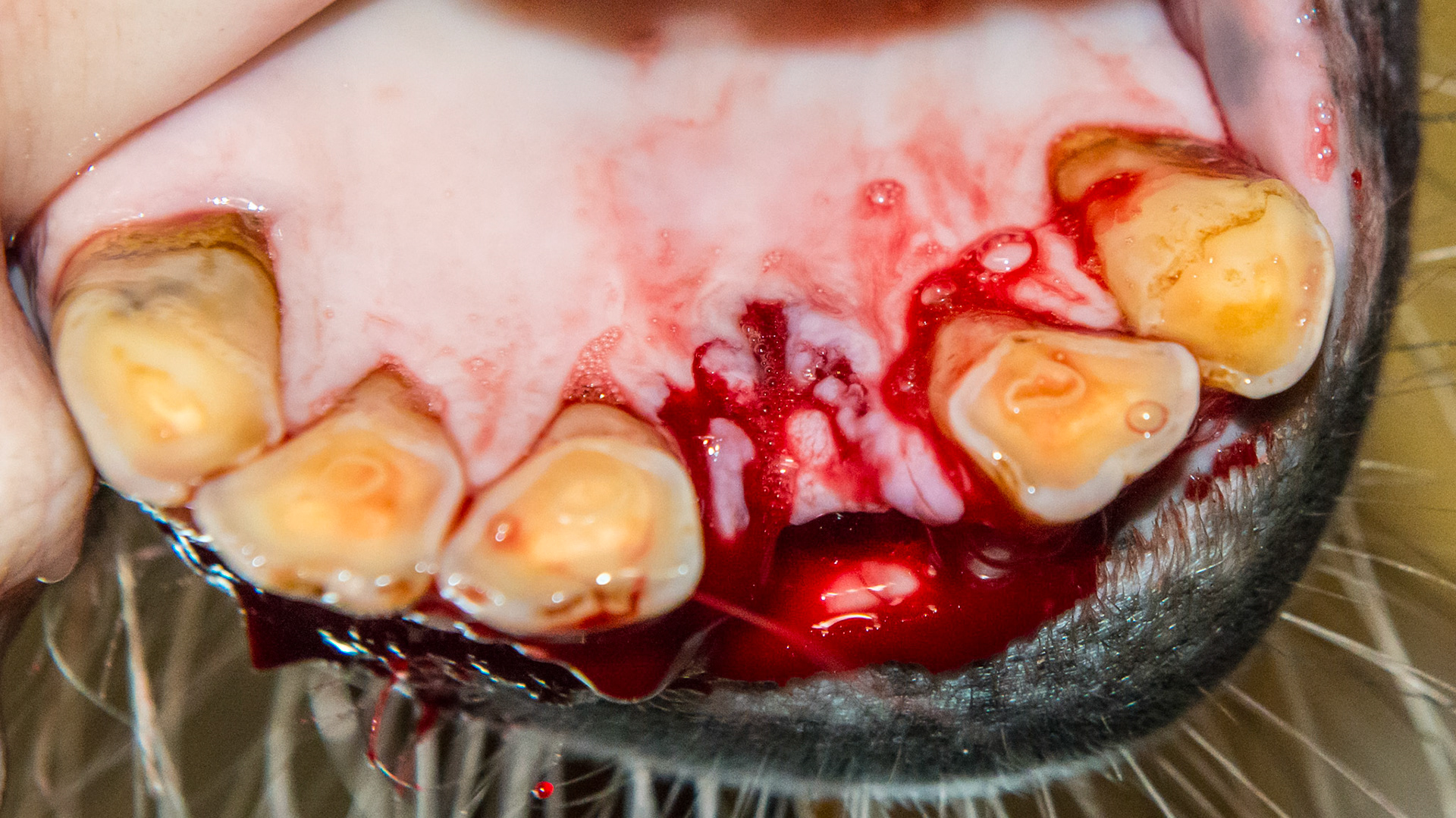 EOTRH horse 17 - #301 coronal fracture due to EOTRH with tooth fragments remaining. The socket cleaned of all palpable pieces of incisor.