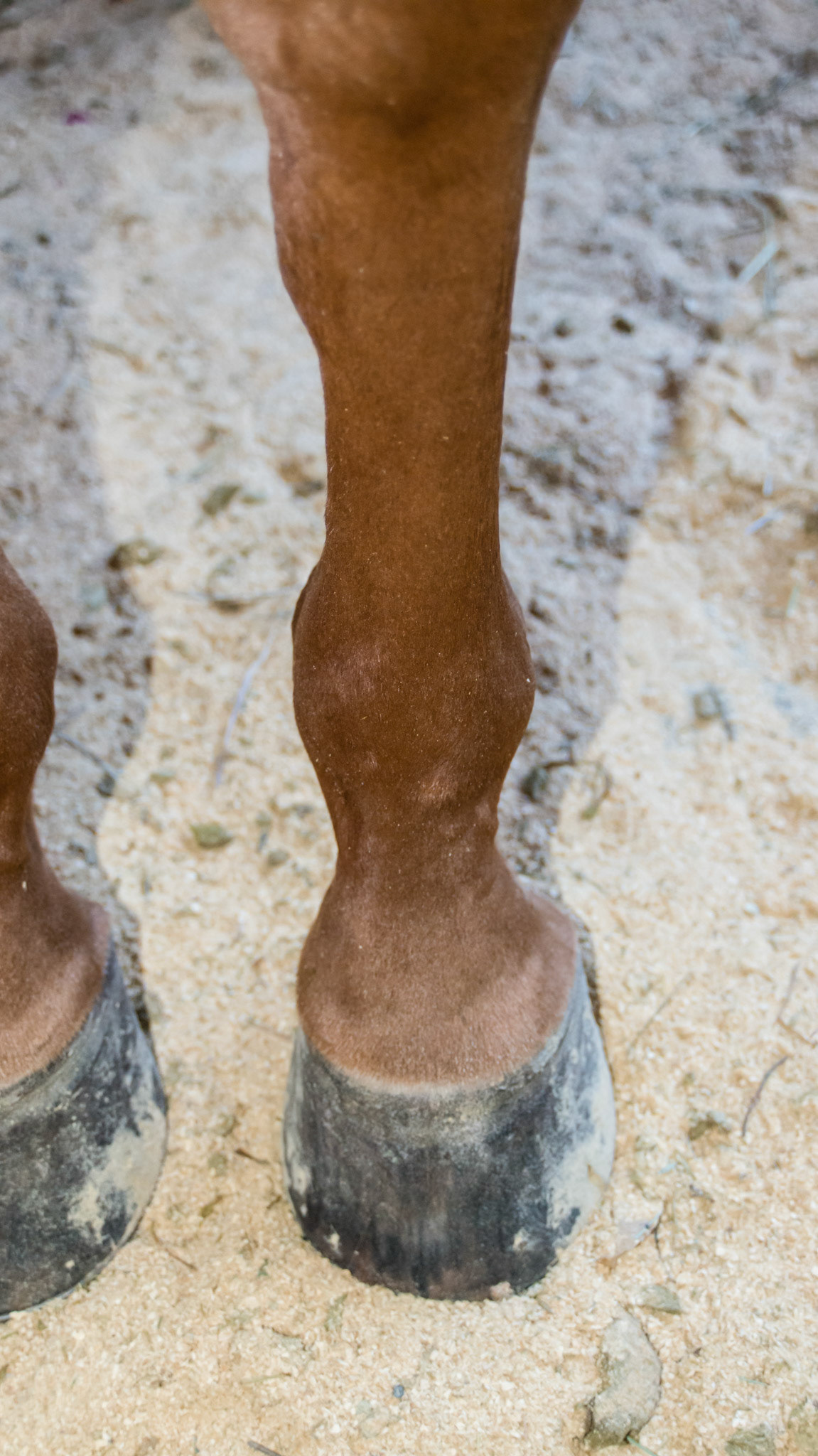 A medial splint seen on the inside of the cannon bone below the knee. This horse has bench knee conformation meaning the cannon bone is placed to the outside of the knee forming a “bench” above and to the outside of the knee forcing the horse’s weight to come down the inside of the cannon bone.  This added load causes the injury. Note the more vertical inside wall of the hoof while the outside wall slightly flares out. Also note the uneven coronary band. The hoof changes are a reaction to the uneven load top the hoof caused by the bad conformation of the cannon to the forearm.