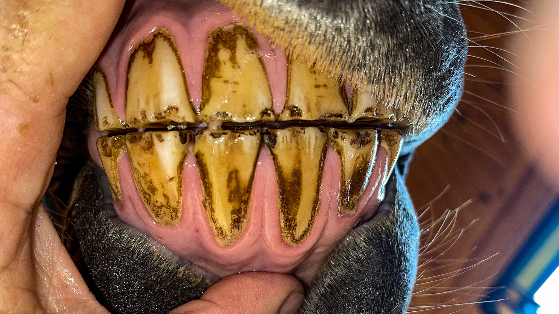 Mild EOTRH shows gum collaring, receding gums, and a few red spots.