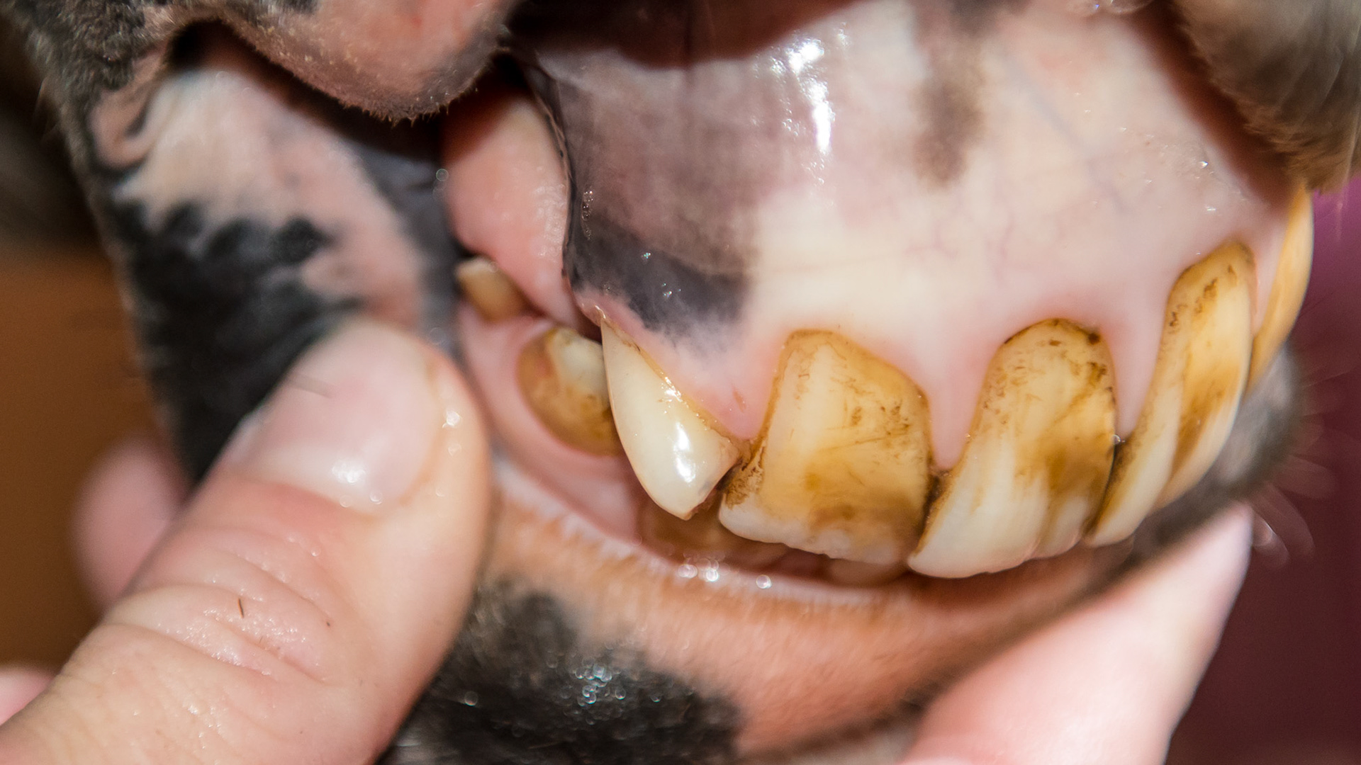 Upper right corner incisor 103 rotated and twisted with the occlusal surface facing forward.