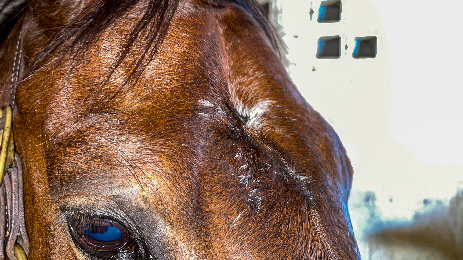 Old skull trauma over the sinus area. Towards the ears is thicker bone covering the brain.