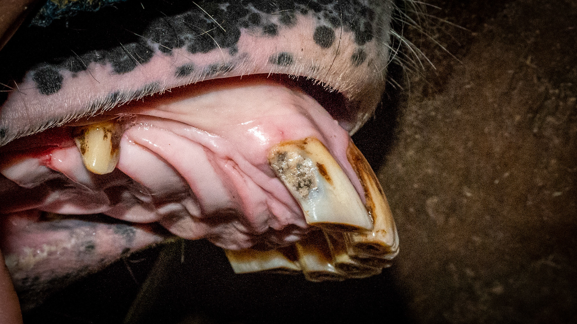 Decay #103 in a 19 year old. The decay has been there for "years" THIS IMAGE is after filing off the edges.