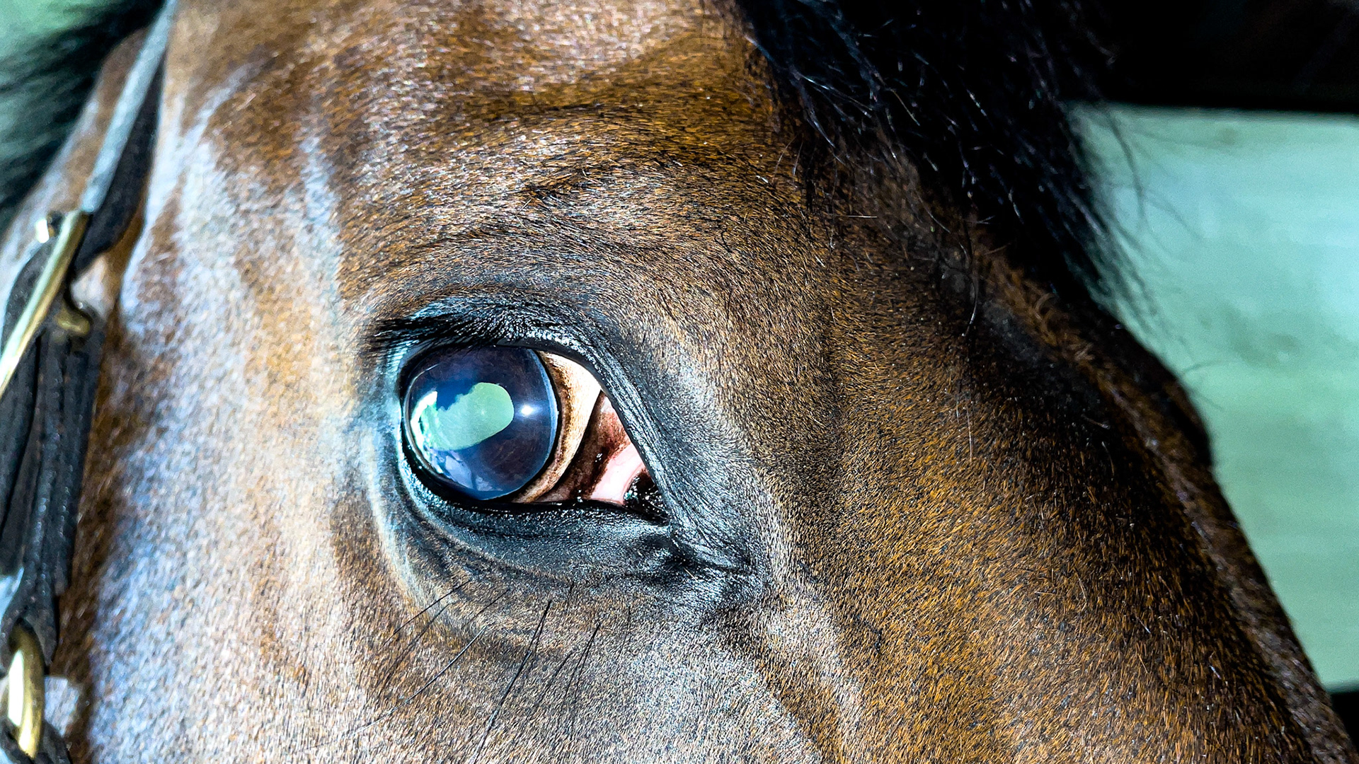 No vision in the right eye. Unknown cause.