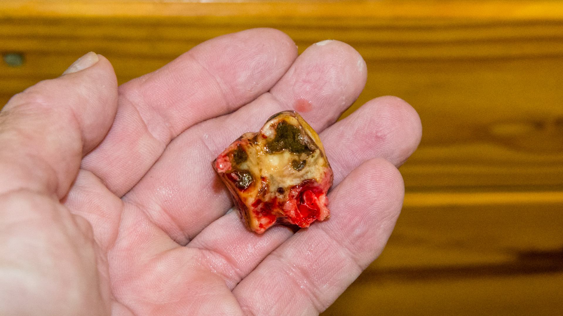 Long tag on a cheek tooth cap could have become a cap remnant.