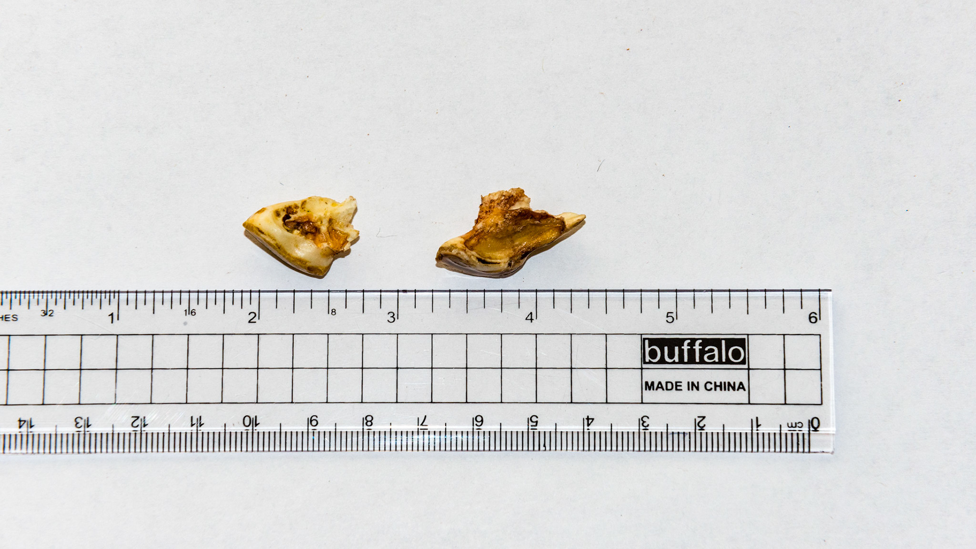 These incisor caps have excessive roots that look more like alveolar bone. Caps like these often remain attached displacing the underlying permanent incisor and requiring extraction by the dentist.