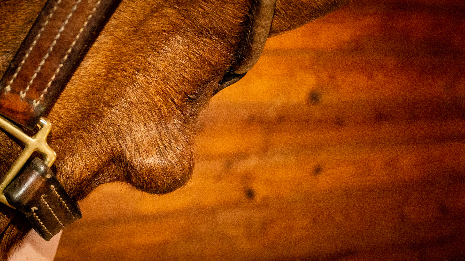 Boney lump that has enlarged from birth in this 25 yr old