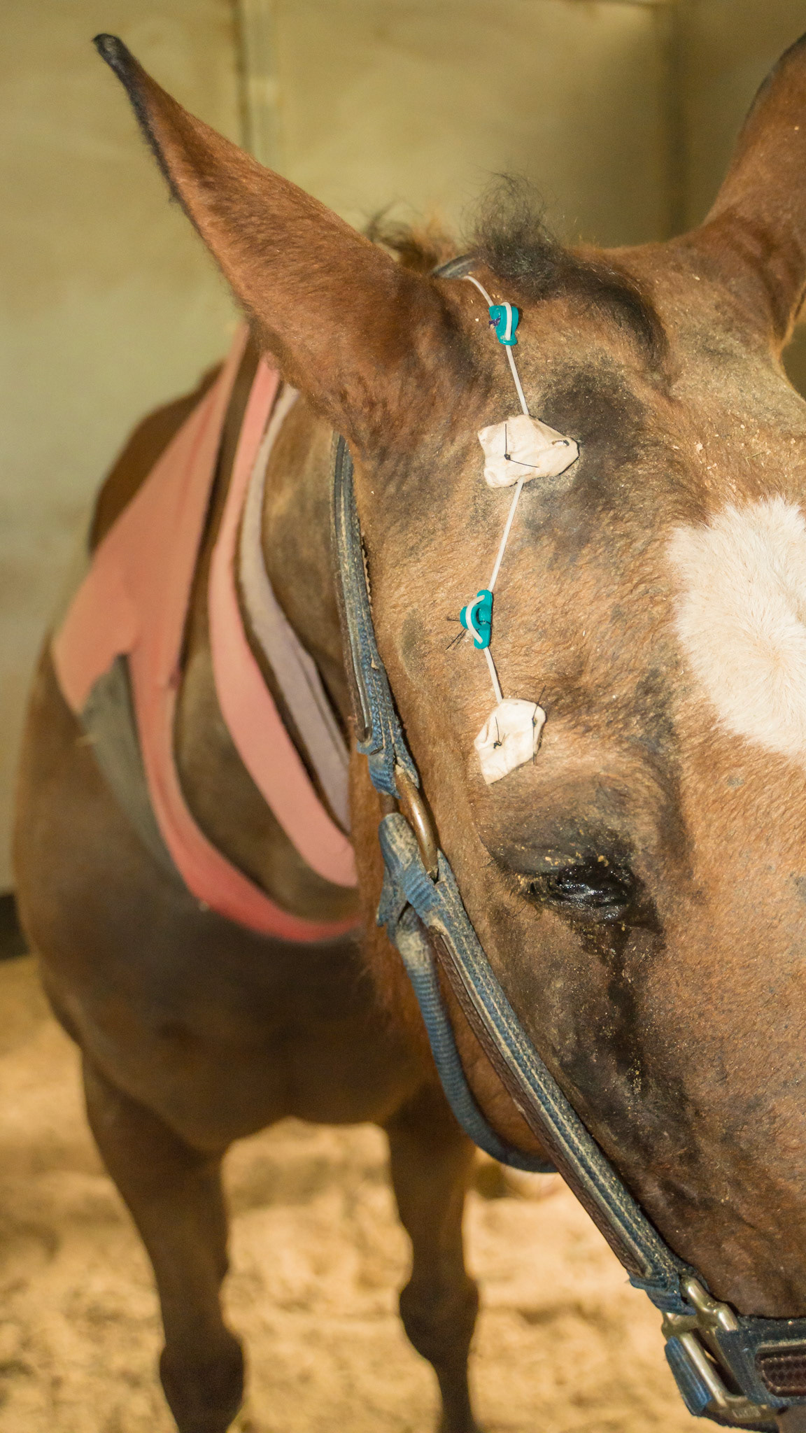 Subpalpebral (under the eyelid) medication administration system allowing medications to be administered into the port at the horse withers rather than directly into the eye.