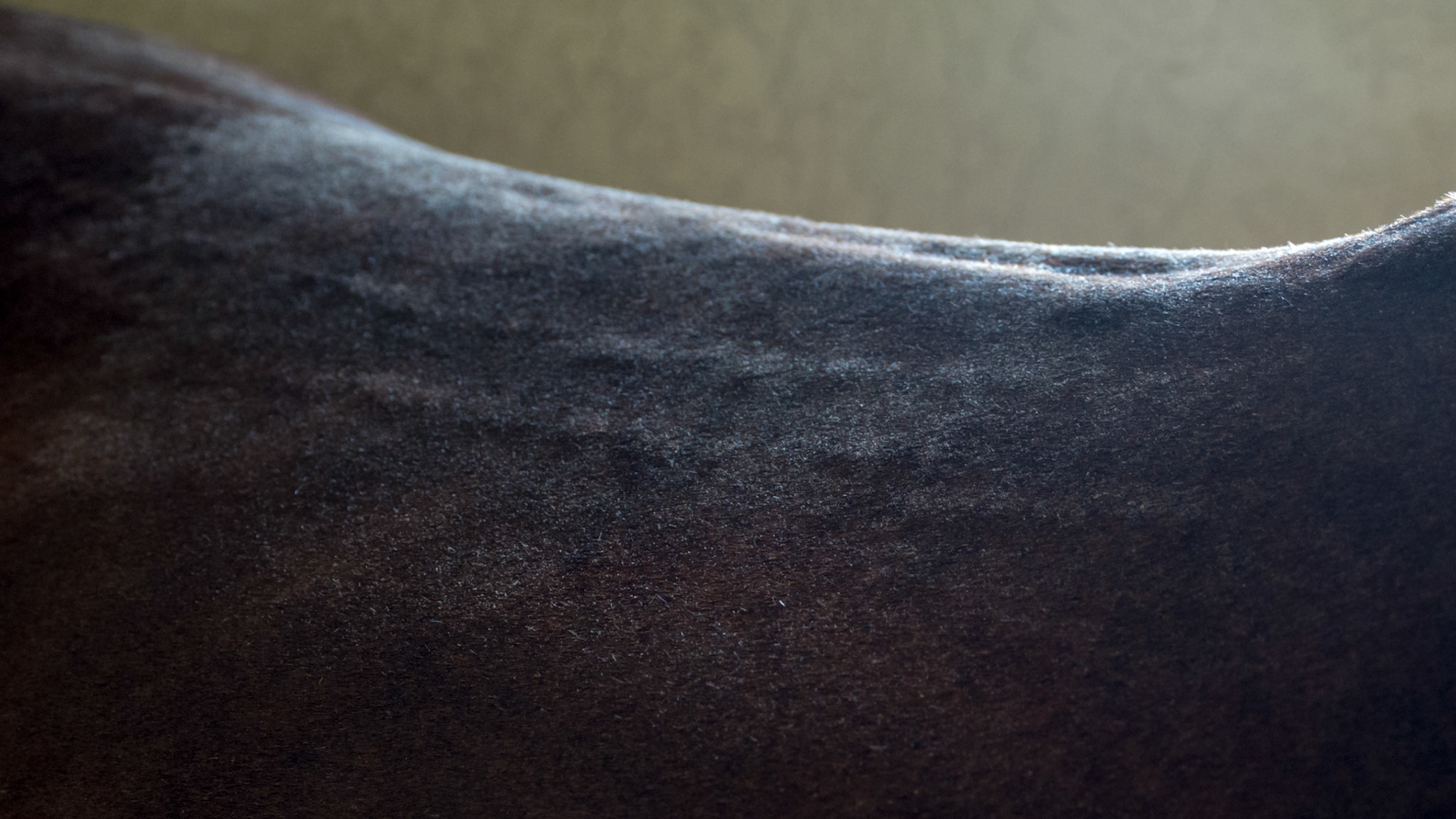 Mesotherapy (multiple needle injections in a pattern to relieve back pain) tracks along the back - treated 2 days ago.