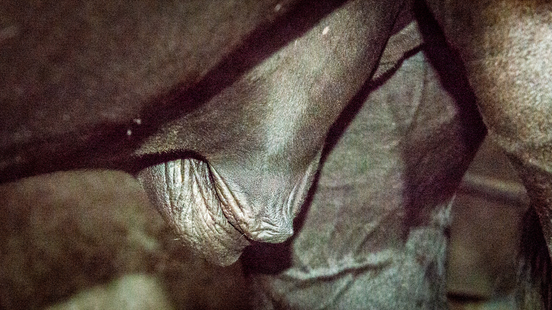 Uneven edema of only the right side of this gelding's sheath.  This may be secondary to the gelding surgery where vessels of the sheath area are damaged preventing drainage.
