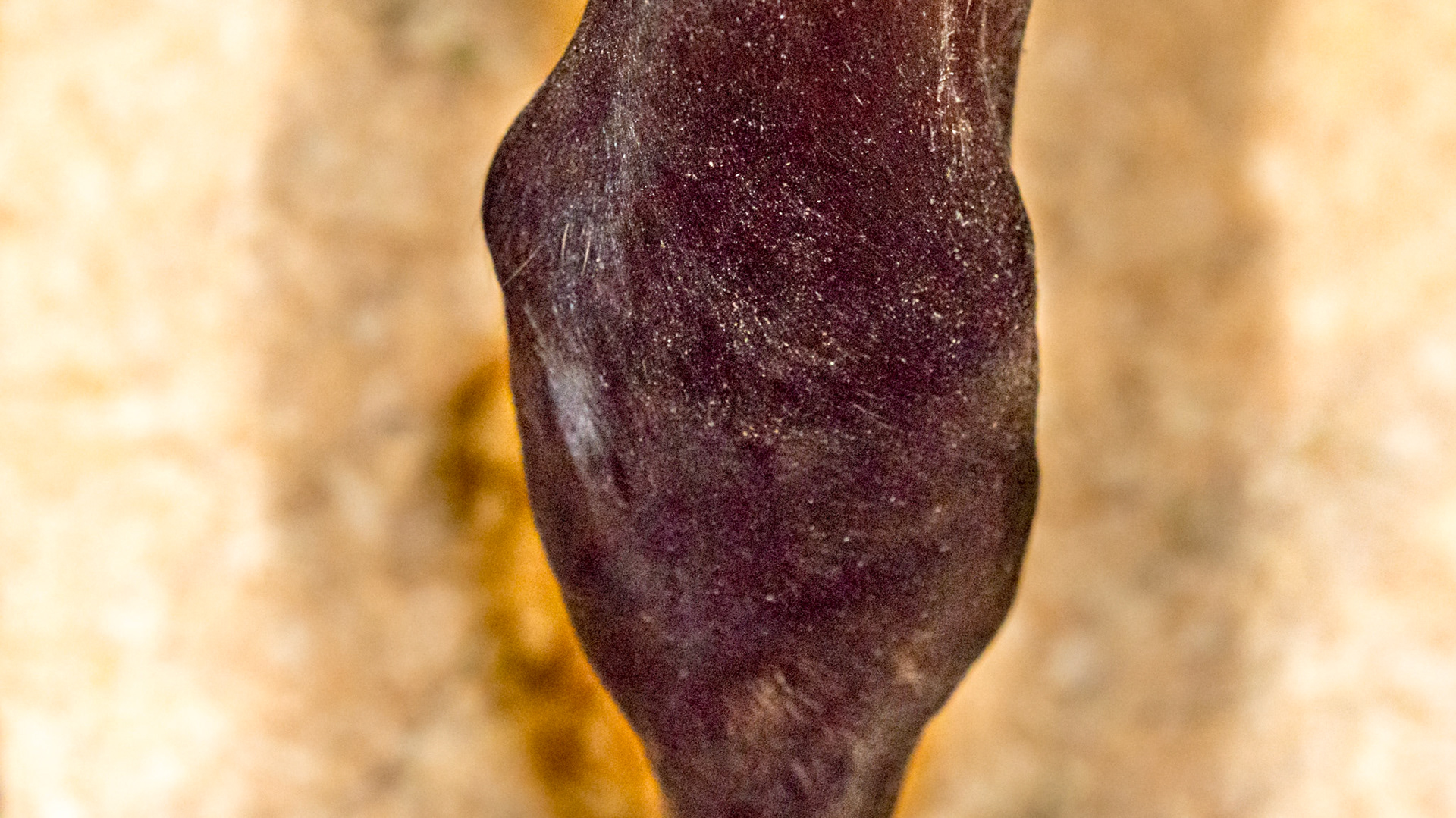 Distal physis (growth plate) of both radius bones (forearm) are enlarged indicating rapid growth from over nutrition.  It is called epiphysitis.