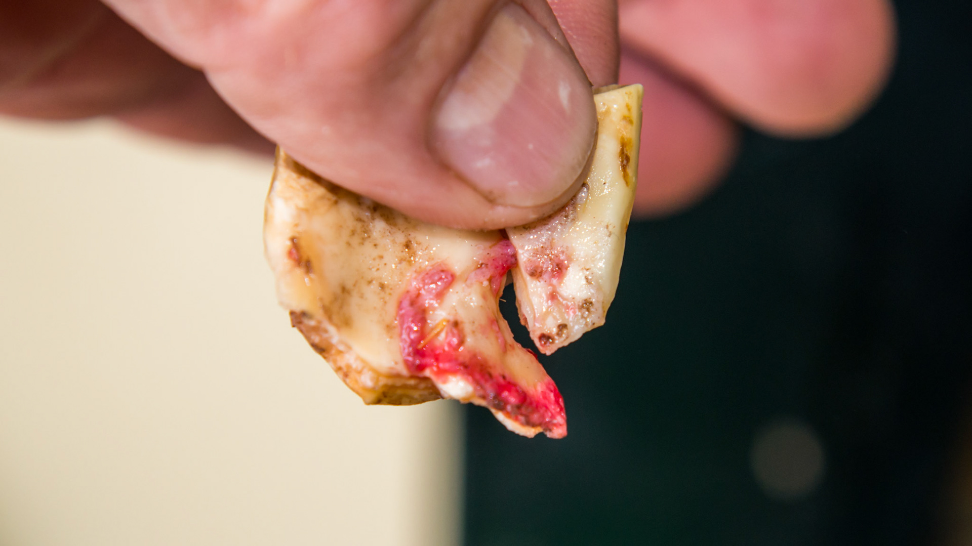 Cheek teeth fracture horse 8 -Extraction of fractured piece from buccal 107 with associated buccal ulcer.The prominent extension of tooth on the distal fractured edge of the fractured piece.