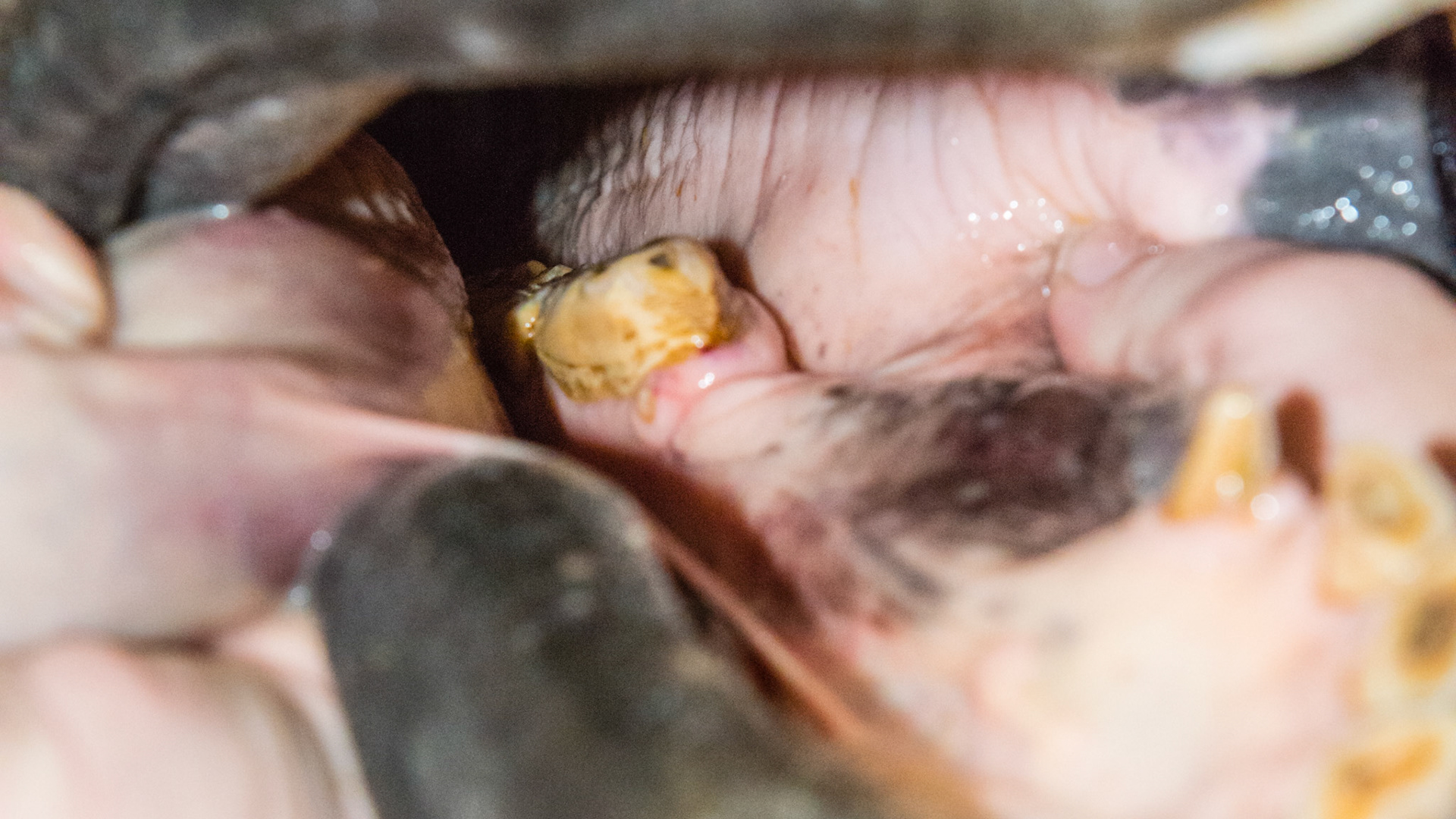 Wolf tooth #305 on the medial side of 306,