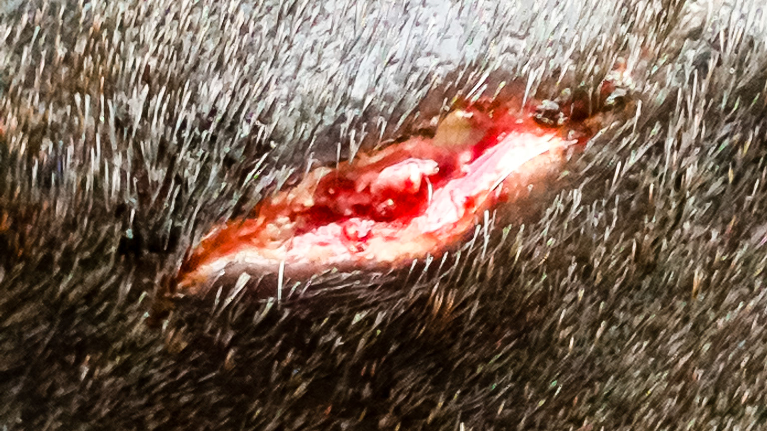 Note how close this small cut on the face is to the underlying vessels.  At first this wound squirted a stream of blood several feet away as the underlying artery was nicked.  Pressure stopped the bleeding through clotting.This wound healed completely with only using a pressure bandage.