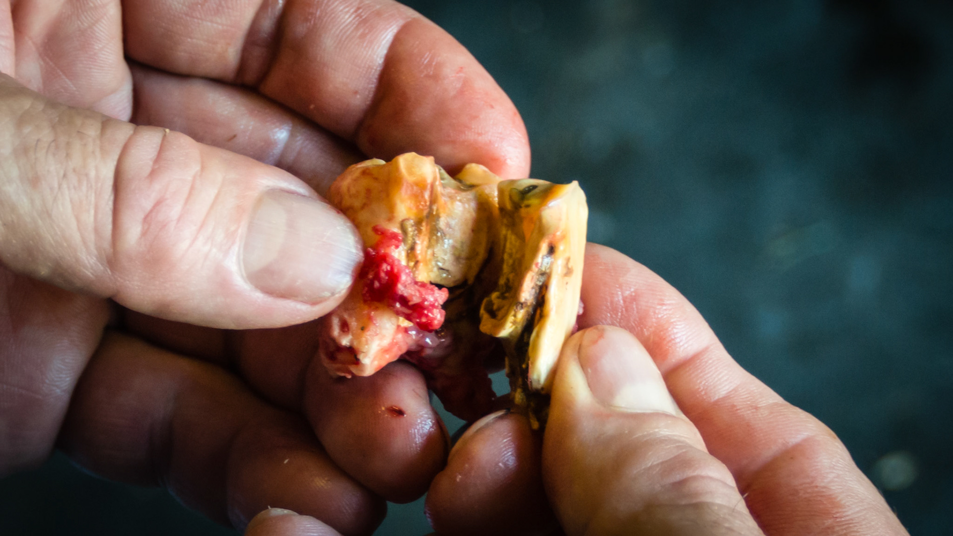 Cheek teeth fracture horse 1 -Fractured piece of 108 on caudal buccal surface was extracted. The remaining tooth and the neighboring 107 were unstable due to age (27 yr, end stage teeth) and were also removed with little effort.